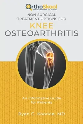 Opciones de tratamiento no quirúrgico para la artrosis de rodilla: Guía informativa para pacientes - Non-Surgical Treatment Options for Knee Osteoarthritis: An Informative Guide for Patients