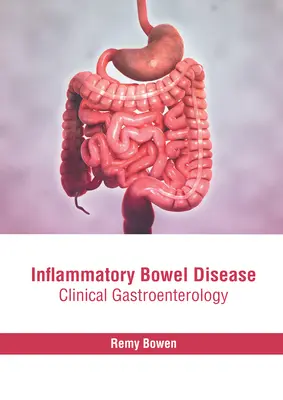 Enfermedad Inflamatoria Intestinal: Gastroenterología Clínica - Inflammatory Bowel Disease: Clinical Gastroenterology