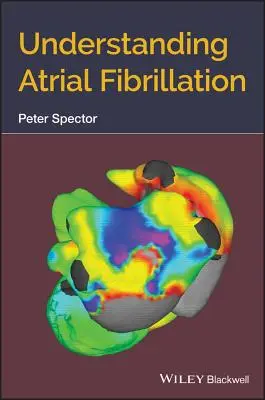 Comprender la fibrilación auricular - Understanding Atrial Fibrillation