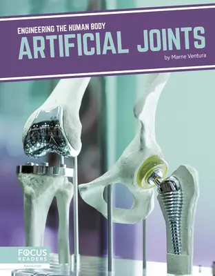 Articulaciones artificiales - Artificial Joints