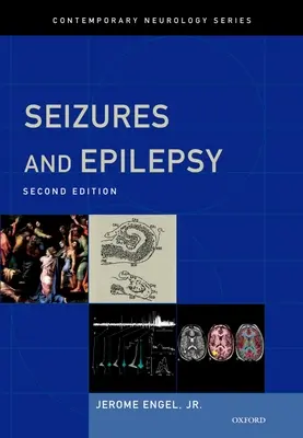 Convulsiones y epilepsia - Seizures and Epilepsy