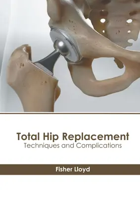 Prótesis total de cadera: Técnicas y complicaciones - Total Hip Replacement: Techniques and Complications