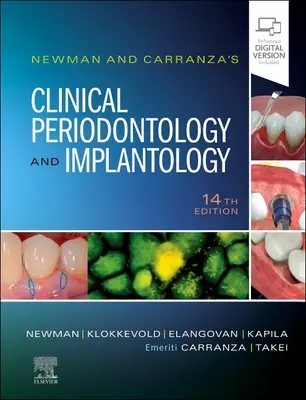 Periodoncia clínica e implantología de Newman y Carranza - Newman and Carranza's Clinical Periodontology and Implantology