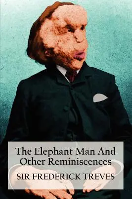 El hombre elefante y otras reminiscencias - The Elephant Man and Other Reminiscences