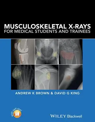 Radiografías musculoesqueléticas para estudiantes y aprendices de medicina - Musculoskeletal X-Rays for Medical Students and Trainees