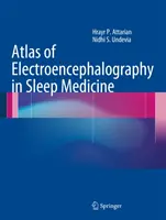 Atlas de electroencefalografía en medicina del sueño - Atlas of Electroencephalography in Sleep Medicine