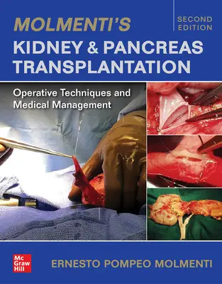 Trasplante de riñón y páncreas de Molmenti: Técnicas operatorias y tratamiento médico - Molmenti's Kidney and Pancreas Transplantation: Operative Techniques and Medical Management