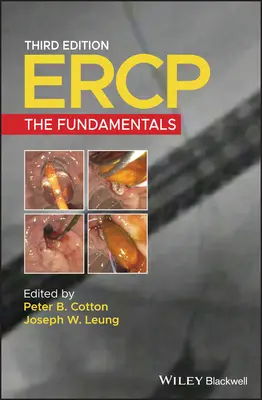 Ercp: Los fundamentos - Ercp: The Fundamentals