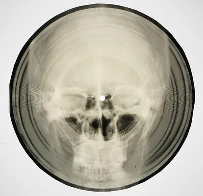 Música de huesos: Soviet X-Ray Audio - Bone Music: Soviet X-Ray Audio