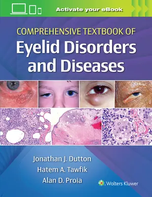 Libro de texto completo de trastornos y enfermedades de los párpados - Comprehensive Textbook of Eyelid Disorders and Diseases