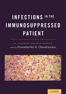 Infecciones en el paciente inmunodeprimido: Un enfoque basado en casos ilustrados - Infections in the Immunosuppressed Patient: An Illustrated Case-Based Approach