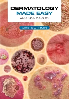 Dermatología fácil, segunda edición - Dermatology Made Easy, Second Edition