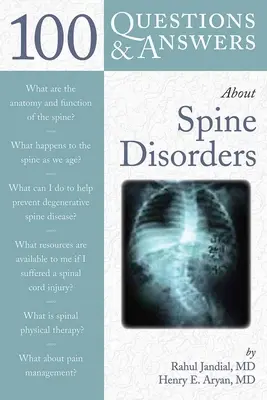 100 preguntas y respuestas sobre trastornos de la columna vertebral - 100 Q&as about Spine Disorders