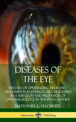 Enfermedades del Ojo: Historia de la Medicina Oftálmica - Tratamientos y Diagnósticos Descritos por un Cirujano y Profesor de Oftalmología en el - Diseases of the Eye: History of Ophthalmic Medicine - Treatments and Diagnoses Described by a Surgeon and Professor of Ophthalmology in the
