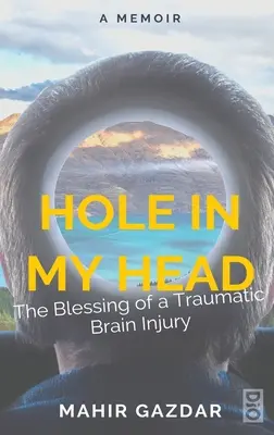 Un agujero en la cabeza: la bendición de una lesión cerebral traumática - Hole in My Head: The Blessing of a Traumatic Brain Injury