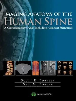 Anatomía por la imagen de la columna vertebral humana: Un atlas exhaustivo que incluye las estructuras adyacentes - Imaging Anatomy of the Human Spine: A Comprehensive Atlas Including Adjacent Structures