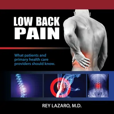 Lumbalgia, lo que deben saber los pacientes y los profesionales sanitarios de atención primaria - Low Back Pain, What patients and primary care health care providers should know