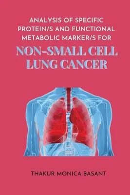 Análisis de la Proteína S Específica y del Marcador Metabólico Funcional S para el Pulmón de Células No Pequeñas - Analysis of Specific Protein S and Functional Metabolic Marker S for Non Small Cell Lung