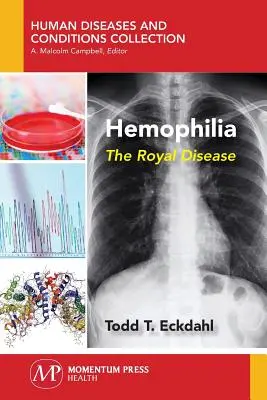 Hemofilia: La enfermedad real - Hemophilia: The Royal Disease