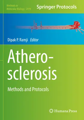 Aterosclerosis: Métodos y protocolos - Atherosclerosis: Methods and Protocols