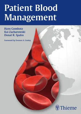 Gestión de la sangre del paciente - Patient Blood Management