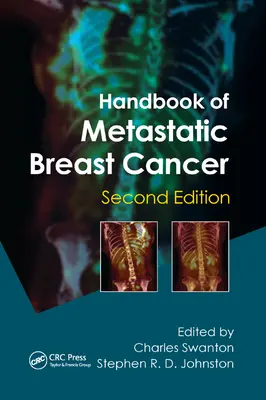 Manual del cáncer de mama metastásico - Handbook of Metastatic Breast Cancer