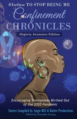 #Me niego a dejar de ser yo: Crónicas del encierro - Edición para la concienciación sobre la alopecia - #Irefuse to Stop Being Me: Confinement Chronicles - Alopecia Awareness Edition