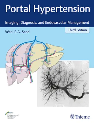 Hipertensión portal: Imágenes, diagnóstico y tratamiento endovascular - Portal Hypertension: Imaging, Diagnosis, and Endovascular Management