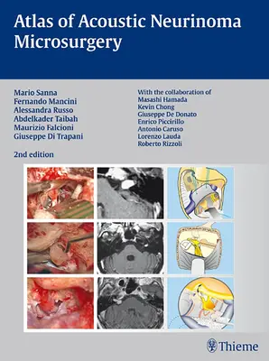 Atlas de microcirugía del neurinoma del acústico - Atlas of Acoustic Neurinoma Microsurgery