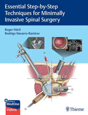 Técnicas esenciales paso a paso para la cirugía mínimamente invasiva de la columna vertebral - Essential Step-By-Step Techniques for Minimally Invasive Spinal Surgery