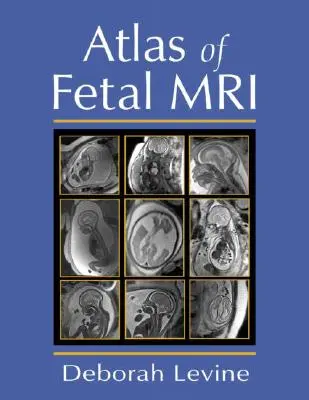 Atlas de resonancia magnética fetal - Atlas of Fetal MRI