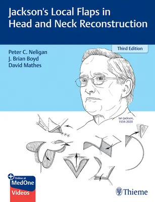 Colgajos locales de Jackson en reconstrucción de cabeza y cuello - Jackson's Local Flaps in Head and Neck Reconstruction