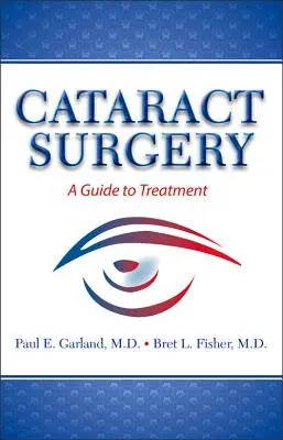 Cirugía de cataratas: Guía de tratamiento - Cataract Surgery: A Guide to Treatment