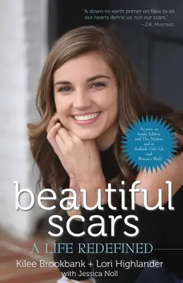 Hermosas cicatrices: Una vida redefinida - Beautiful Scars: A Life Redefined