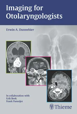 Imágenes para otorrinolaringólogos - Imaging for Otolaryngologists