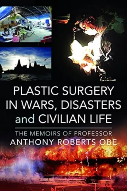 La cirugía plástica en las guerras, las catástrofes y la vida civil: Memorias del profesor Anthony Roberts OBE - Plastic Surgery in Wars, Disasters and Civilian Life: The Memoirs of Professor Anthony Roberts OBE