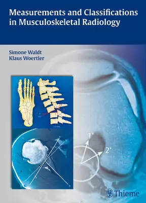 Medidas y clasificaciones en radiología musculoesquelética - Measurements and Classifications in Musculoskeletal Radiology