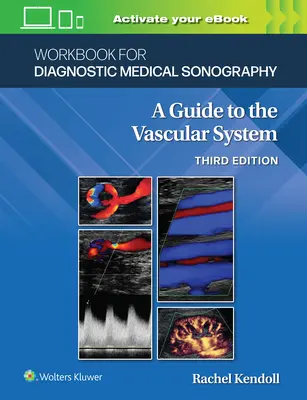 Workbook for Diagnostic Medical Sonography: Los sistemas vasculares - Workbook for Diagnostic Medical Sonography: The Vascular Systems