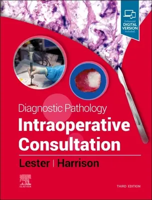 Patología Diagnóstica: Consulta intraoperatoria - Diagnostic Pathology: Intraoperative Consultation