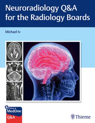 Neuroradiology Q&A for the Radiology Boards (Preguntas y respuestas sobre neurorradiología para los exámenes de radiología) - Neuroradiology Q&A for the Radiology Boards