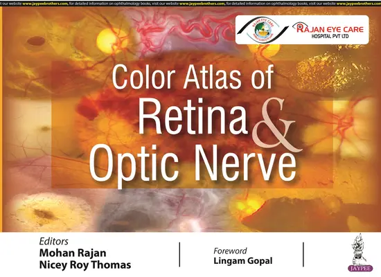 Atlas en color de retina y nervio óptico - Color Atlas of Retina & Optic Nerve