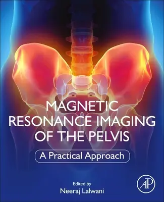 Resonancia magnética de la pelvis: Un enfoque práctico - Magnetic Resonance Imaging of the Pelvis: A Practical Approach