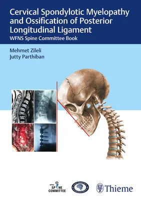 Mielopatía espondilótica cervical y osificación del ligamento longitudinal posterior: Wfns Spine Committee Book - Cervical Spondylotic Myelopathy and Ossification of Posterior Longitudinal Ligament: Wfns Spine Committee Book