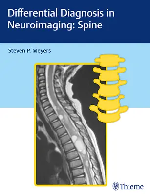 Diagnóstico diferencial en neuroimagen: Spine - Differential Diagnosis in Neuroimaging: Spine