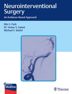 Cirugía Neurointervencionista: Un enfoque basado en la evidencia - Neurointerventional Surgery: An Evidence-Based Approach