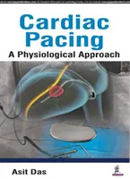 Estimulación cardiaca: un enfoque fisiológico - Cardiac Pacing a Physiological Approach