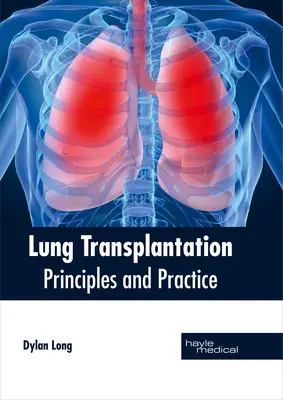 Trasplante de pulmón: Principios y práctica - Lung Transplantation: Principles and Practice