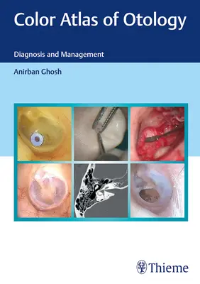 Atlas en color de otología: Diagnóstico y Manejo - Color Atlas of Otology: Diagnosis and Management