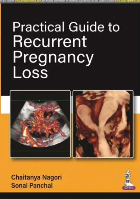 Guía práctica de la pérdida recurrente del embarazo - Practical Guide to Recurrent Pregnancy Loss