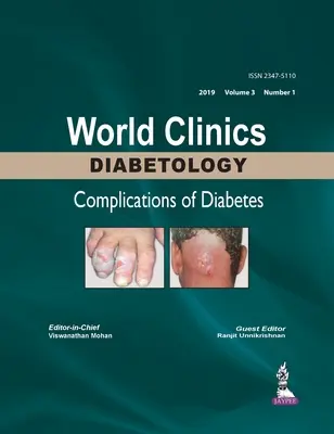 Clínicas Mundiales de Diabetología: Complications of Diabetes - Volumen 3, Número 1 - World Clinics Diabetology: Complications of Diabetes - Volume 3, Number 1